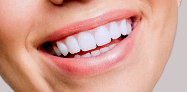 Invisalign Aligner Photo