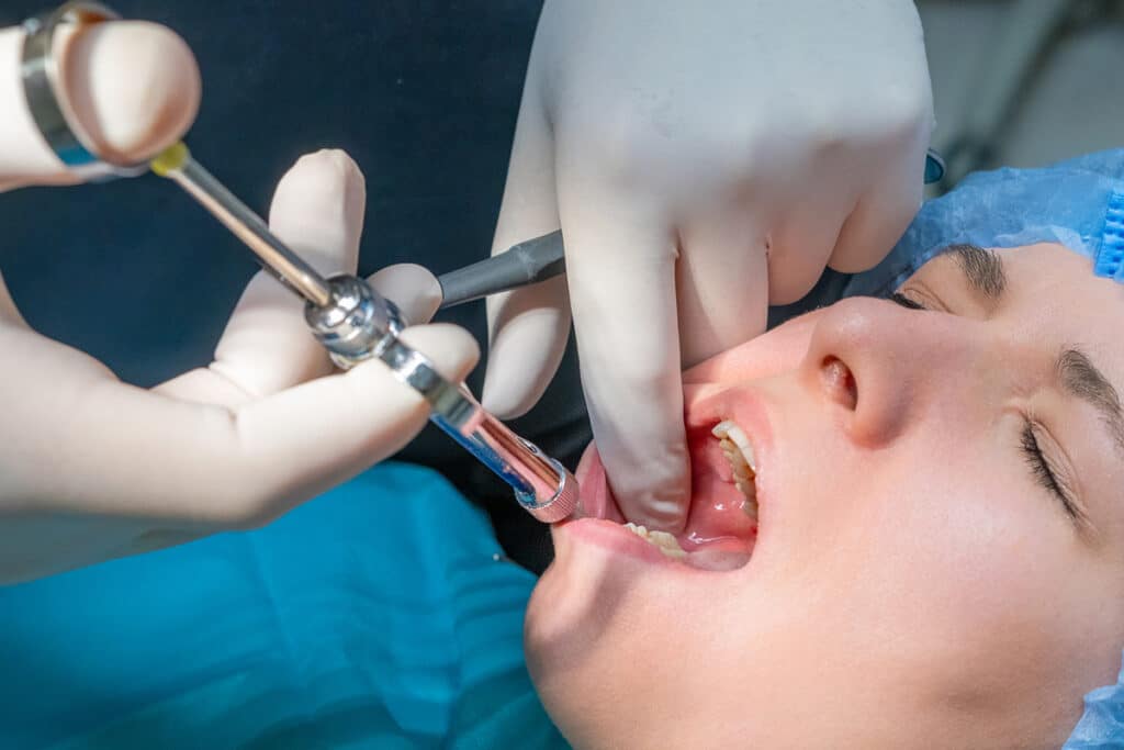 What You Should Know Before Your First Sedation Dentistry Appointment in Plainview, NY