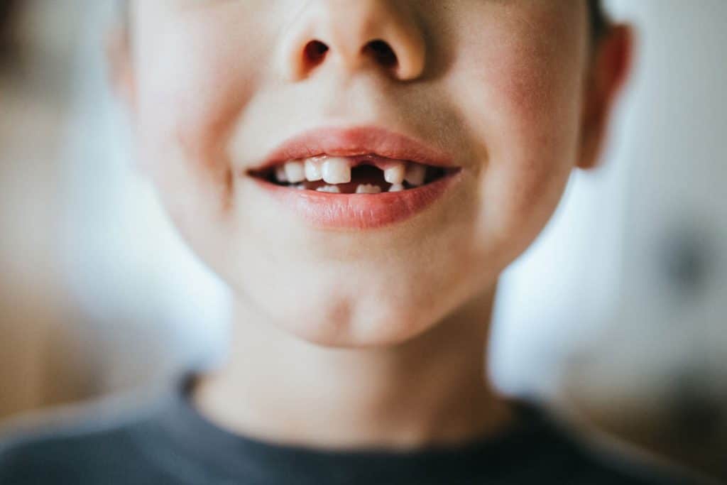 My Child Knocked Out a Tooth! Now What?